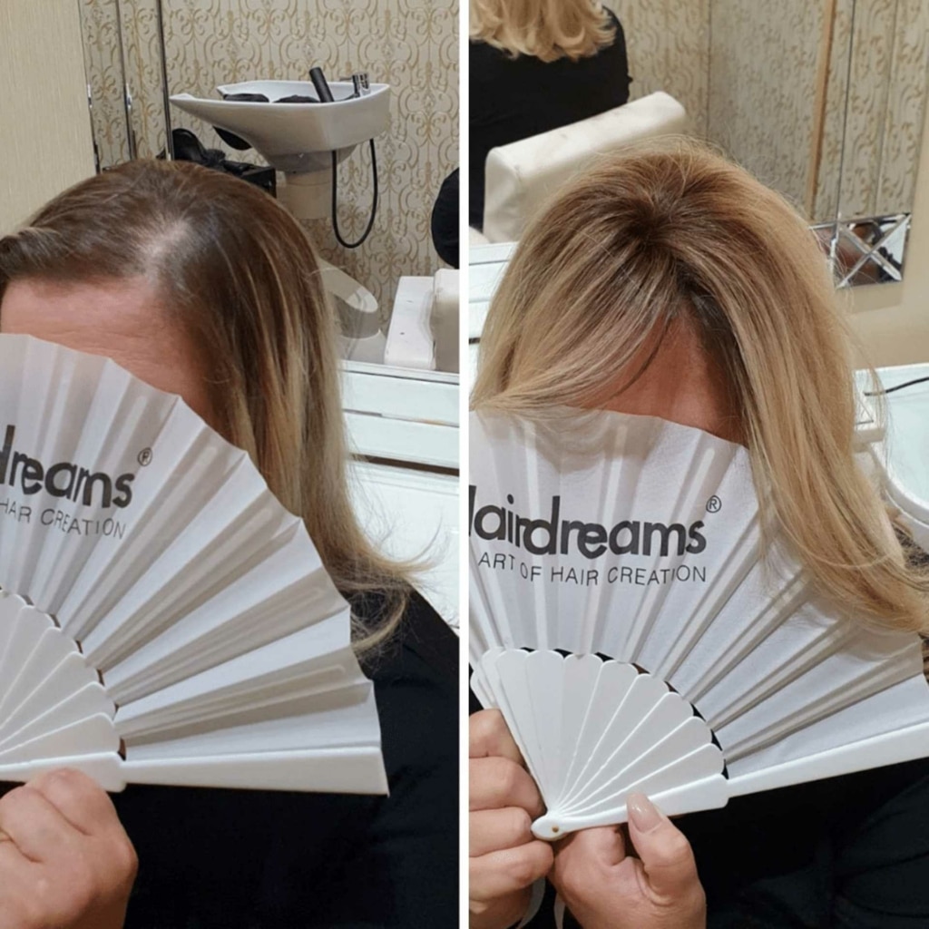 Before and after picture of hair thickening on the top of the head for a woman with blonde hair
