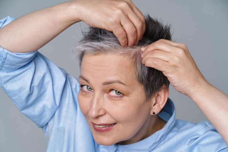 Une femme montre le début de la chute de ses cheveux