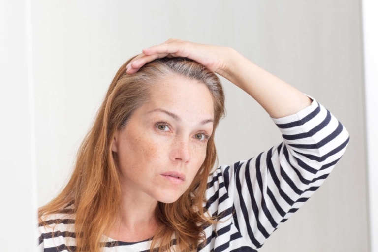 Woman looking at her scalp