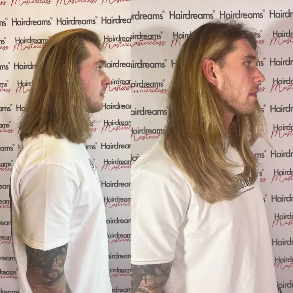 Vorher-Nachher Vergleich - Mann mit Haarverlängerung